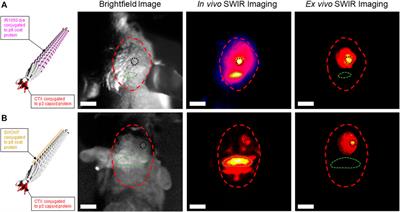 Forging the Frontiers of Image-Guided Neurosurgery—The Emerging Uses of Theranostics in Neurosurgical Oncology